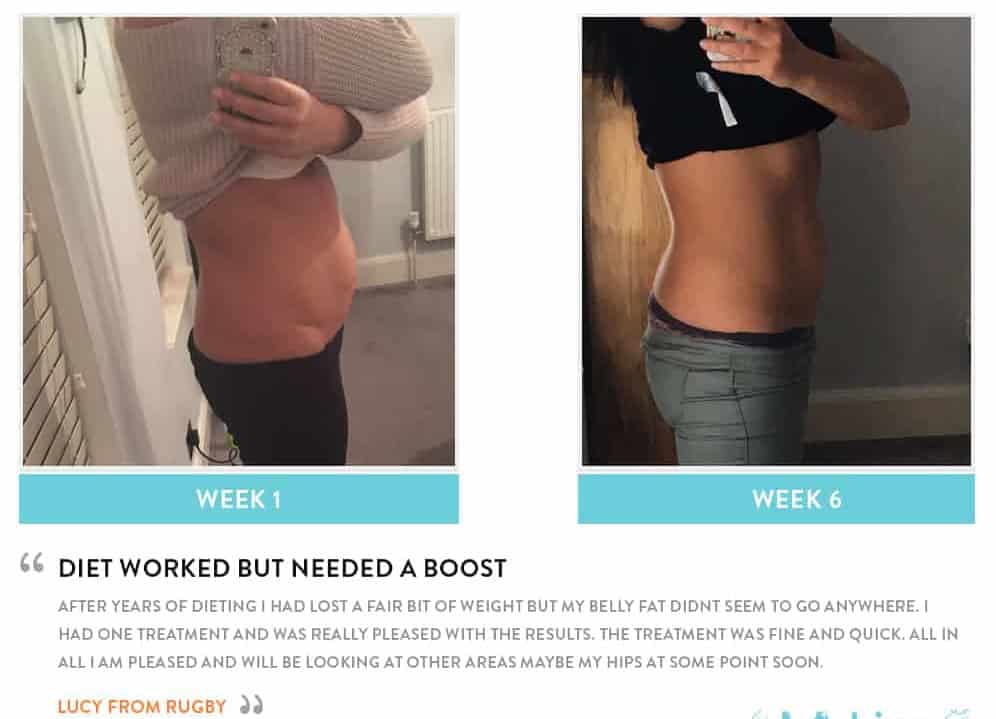 Before and After Dieting Cheshunt
