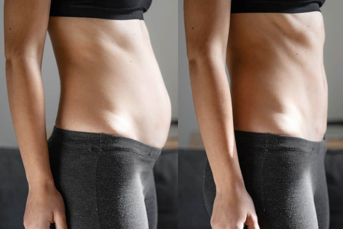 Post-Pregnancy: What Happens to Your Abdominal Muscles After Birth Cheshunt