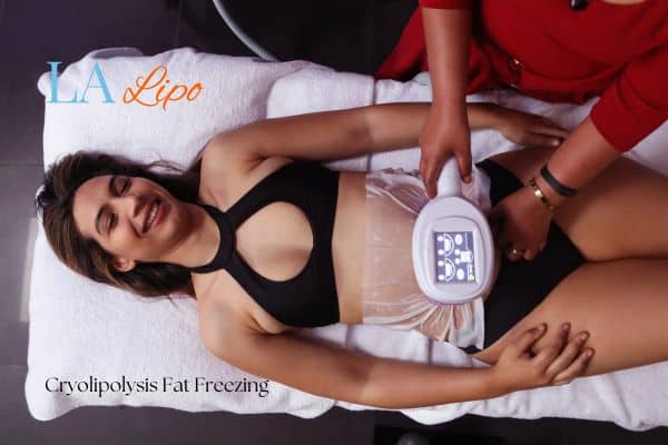 woman getting cryolipolysis Cheshunt