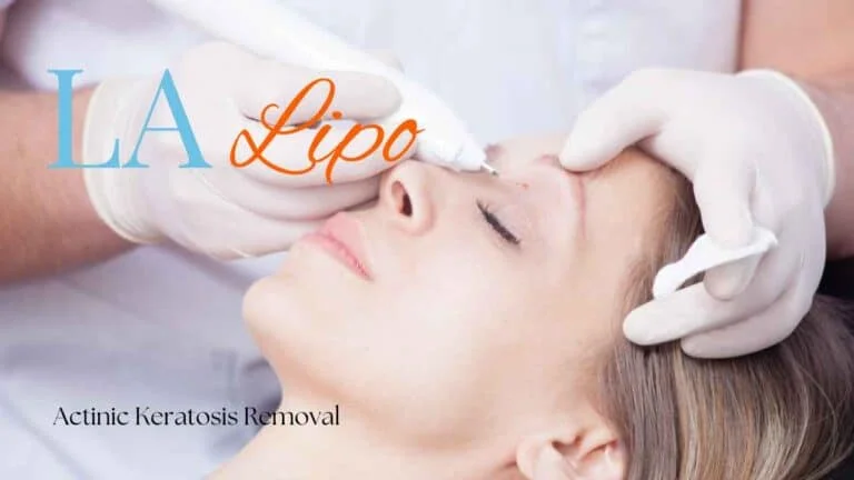 Woman receiving Actinic Keratosis Removal Treatment Cheshunt