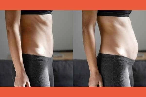 LA-EMS Body Sculpting results Cheshunt