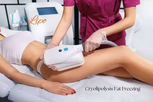 Woman receiving coolsculpting Cheshunt treatment on her thighs