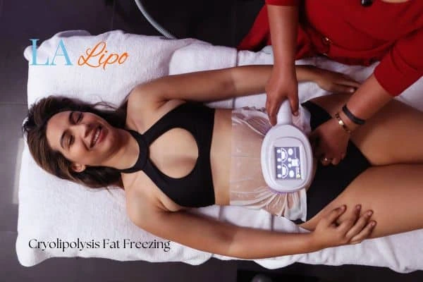 woman getting cryolipolysis Cheshunt