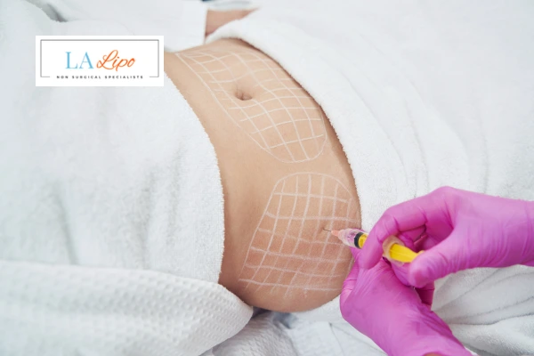 aqualyx fat dissolving injections Cheshunt
