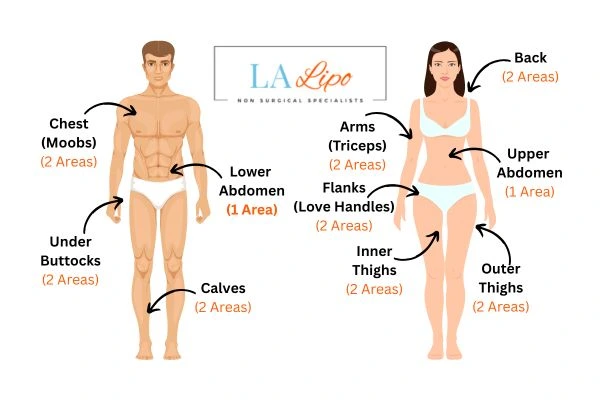 LA LIPO Cryolipolysis Areas Cheshunt