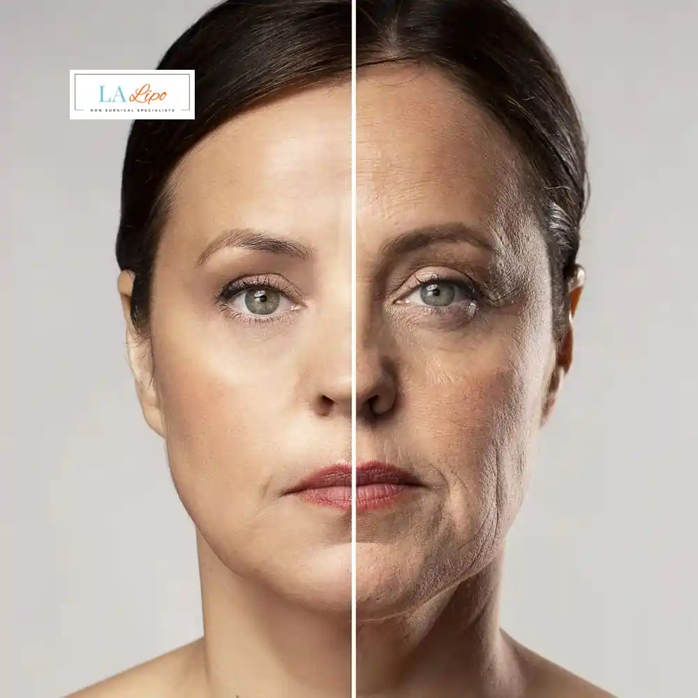 How Can You Tell If Non-Surgical Skin Tightening Is Right for You Cheshunt?