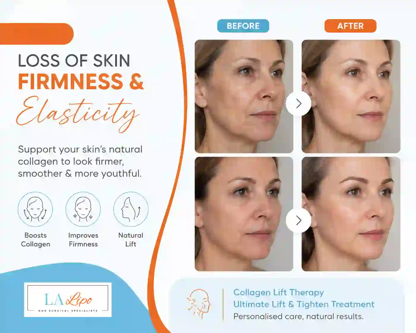 Sign #7: Loss of Skin Firmness and Elasticity Cheshunt