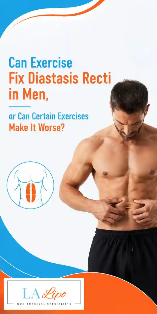 Can Exercise Fix Diastasis Recti in Men, or Can Certain Exercises Make It Worse Cheshunt?