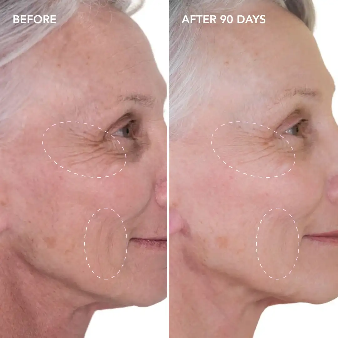 When will you see results Cheshunt